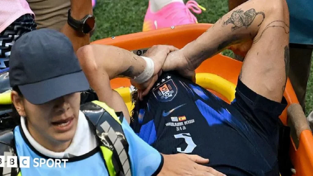 ugarte-has-most-serious-injury-footballer-can-face-yxXNh8Cn.webp